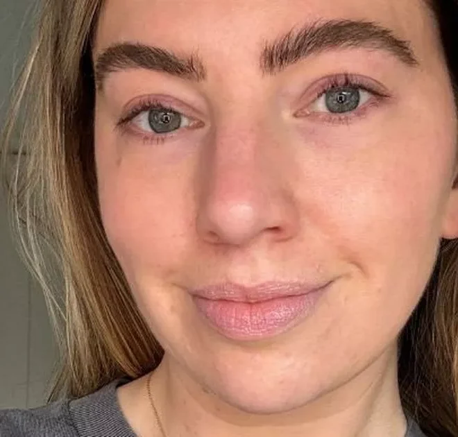 ‘This new “Botox in a bottle” serum is the best I’ve tried for smooth and glowing skin’