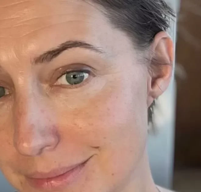 Hollyoaks legend Ali Bastian shares emotional cancer update after mastectomy