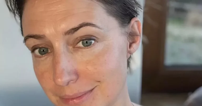 Hollyoaks legend Ali Bastian shares emotional cancer update after mastectomy