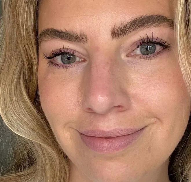 ‘This is the only moisturiser I’ll use on my blemish-prone skin and it now has 20% off’